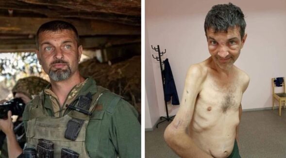 Haunting images of Ukrainian soldier before and after Russian captivity